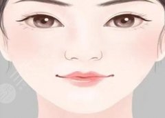 人中缩短手术怎么做,会留疤吗?手术原理科普! 人中缩短手术怎么做,会留疤吗?手术原理科普!