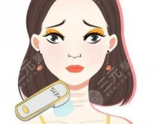 人工韧带提升面部多少钱?在哪做?项目咨询盘点 人工韧带提升面部多少钱?在哪做?项目咨询盘点