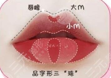 m唇