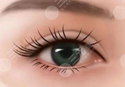 弋矶山医院双眼皮手术