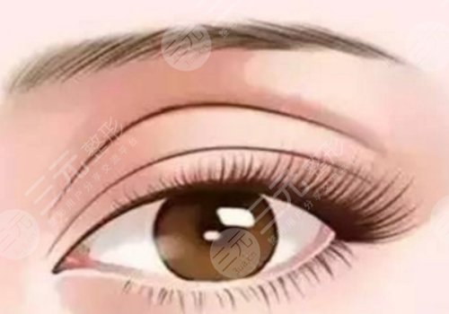 弋矶山医院双眼皮价格