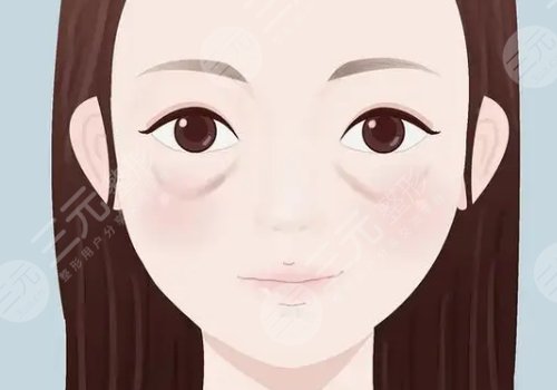 苏州市立医院双眼皮修复价格
