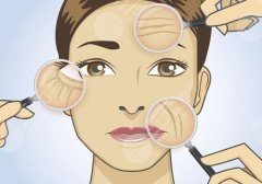 眼下干纹做什么医美？激光、玻尿酸、热玛吉等优势分析！