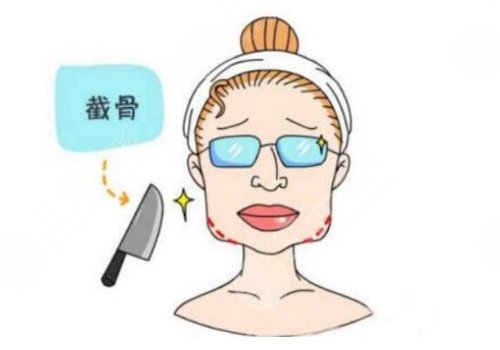 割下颌角多少钱