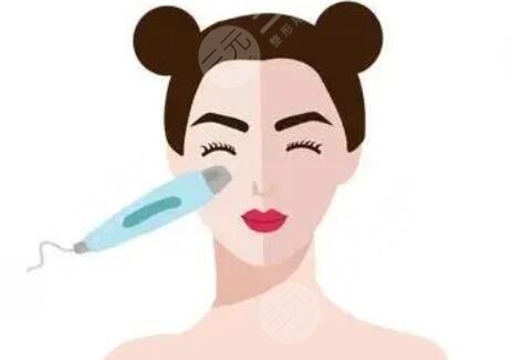 点阵激光