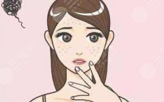 全脸点阵激光一次多少钱?2500元起体验医疗美容! 全脸点阵激光一次多少钱?2500元起体验医疗美容!