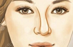 鼻子歪是什么原因?5种歪鼻情况,矫正整形必看! 鼻子歪是什么原因?5种歪鼻情况,矫正整形必看!