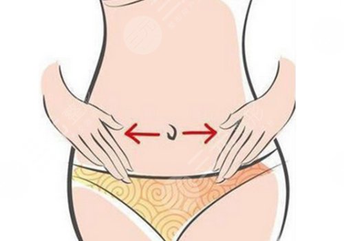 吸脂瘦腰方法怎么样