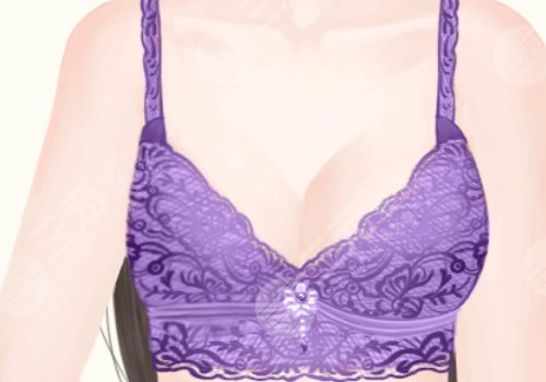 乳房填充脂肪多少钱