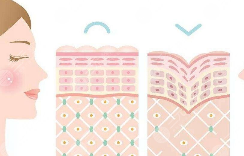 菲欧曼和菲洛嘉的区别有哪些