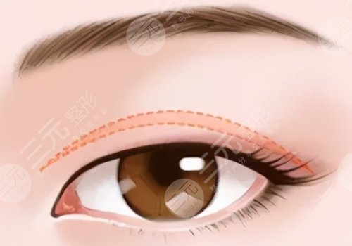 肖文明医生重庆当代口碑怎么样