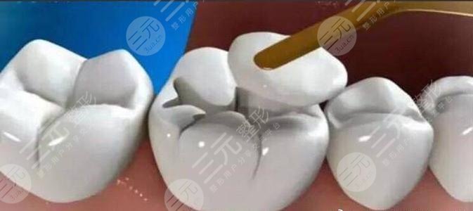 杭州第二人民医院口腔科