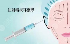耳基底打几支玻尿酸?注射填充科普指南! 耳基底打几支玻尿酸?注射填充科普指南!