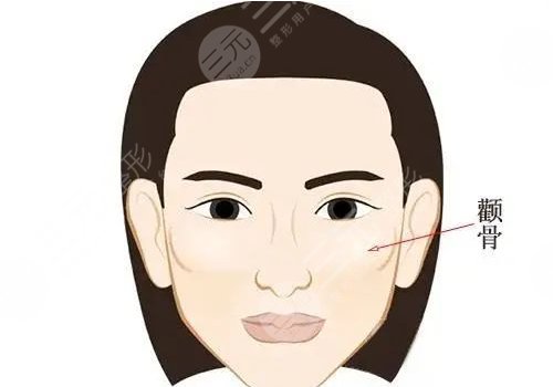 颧骨高怎么整容