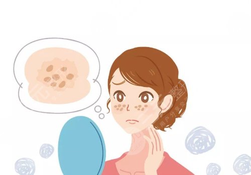 e光整形美容嫩肤祛斑