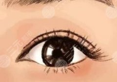 双眼皮留疤了能修复吗?双眼皮失败后多久做修复? 双眼皮留疤了能修复吗?双眼皮失败后多久做修复?