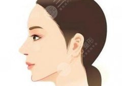 下巴整容多少钱?价格大概5000到20000元起步 下巴整容多少钱?价格大概5000到20000元起步