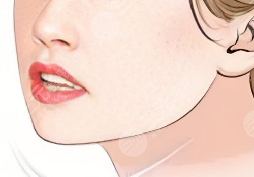 下颌骨歪斜怎么矫正