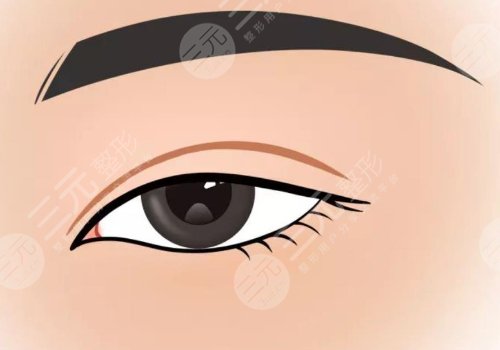 修复双眼皮的价格