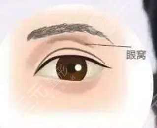 眼窝凹陷