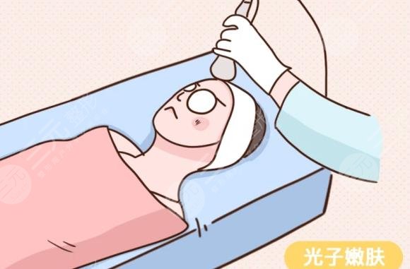 光子嫩肤