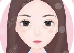 胶原蛋白填充泪沟维持多久?科普分析,靓眼指南! 胶原蛋白填充泪沟维持多久?科普分析,靓眼指南!