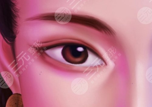 双眼皮三个月可以修复吗