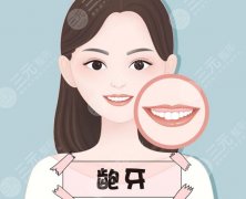 龅牙嘴凸怎么办,正畸还是正颌?科普帮你分析! 龅牙嘴凸怎么办,正畸还是正颌?科普帮你分析!