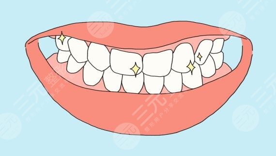 牙齿矫正