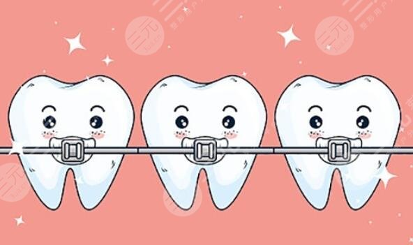 牙齿矫正
