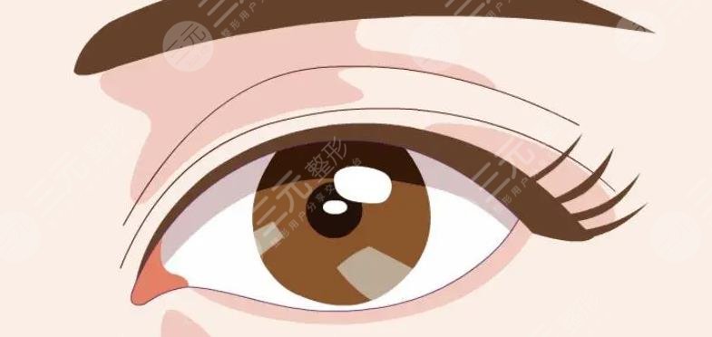 开眼角