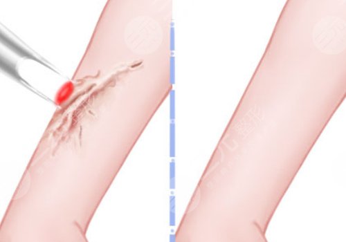 益阳德美整形口碑好吗