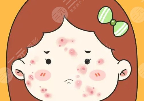 四会紫盈美容院去痘坑怎么样