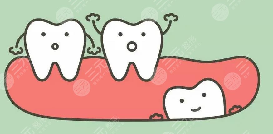 南京(江苏)省人民医院种植牙收费标准