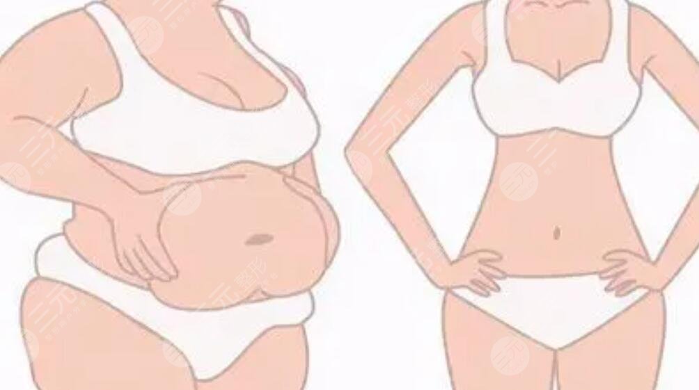 吸脂