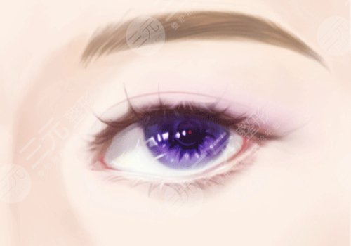 双眼皮二次修复要钱不