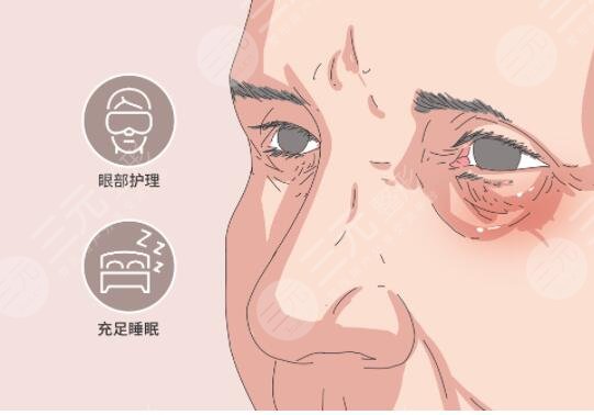 去眼袋