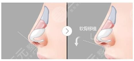 上海国际医学中口碑点评