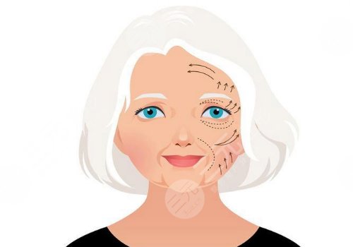 广州大拉皮手术价格