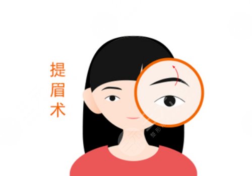 成都友谊整形美容医院做提眉做的好的医生