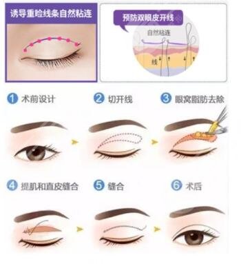 王太玲医生擅长项目