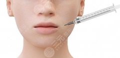 丰唇玻尿酸哪个牌子好?乔雅登、娇兰、德珠红唇等都不错! 丰唇玻尿酸哪个牌子好?乔雅登、娇兰、德珠红唇等都不错!
