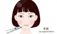 纹唇的好处和坏处有哪些?作用及优势剖析!科普知识汇总! 纹唇的好处和坏处有哪些?作用及优势剖析!科普知识汇总!