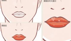纹唇一般多少钱左右?效果好不好?纹唇后注意事项盘点! 纹唇一般多少钱左右?效果好不好?纹唇后注意事项盘点!
