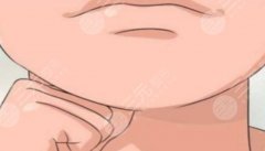 颏成型下巴衔接不自然？第一次颏成型不够还能做第二次吗?
