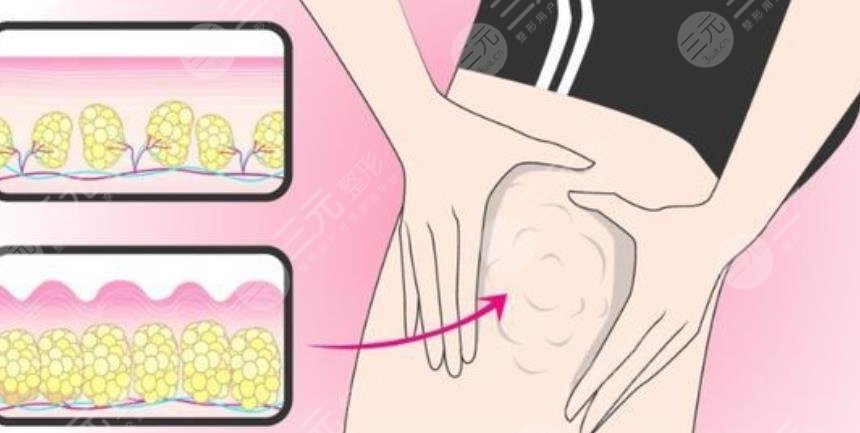大腿