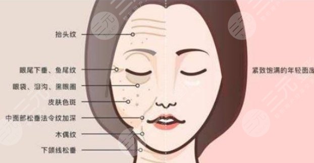 面部提升