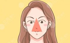 peek眉心三角区可以垫吗？peek有哪些优势和特点？