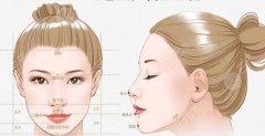 peek下巴后遗症有哪些?看完这些你还敢做吗? peek下巴后遗症有哪些?看完这些你还敢做吗?