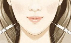 面部吸脂会不会导致皮肤松弛吗？手术原理及注意事项盘点！